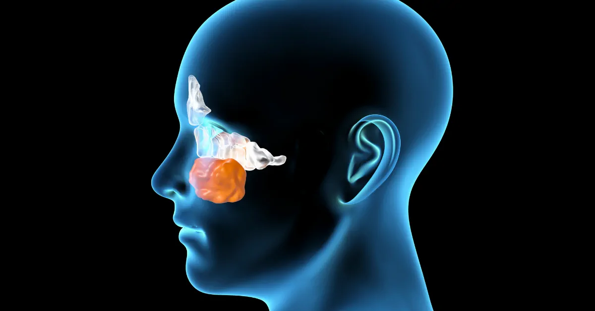 At odds with my Sinuses